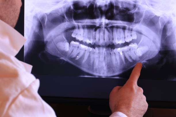 Best Broken or Cracked Tooth Emergency Dentist in Woodlawn, OH