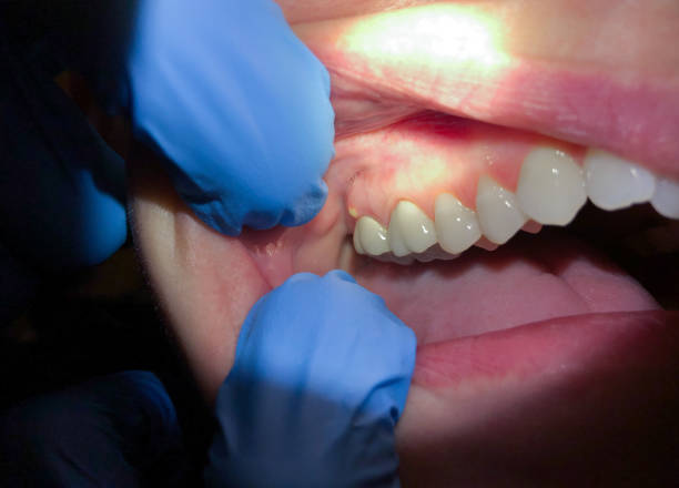 Best Emergency Cosmetic Dentistry in Woodlawn, OH